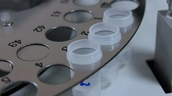 Espetrometria Espetroscopia de absorção atómica